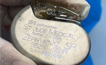 Caso Clínico: Recambio de Generador