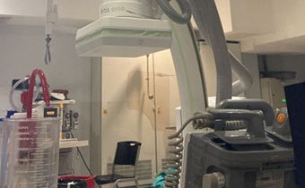 Caso Clínico: Infarto agudo del miocardio